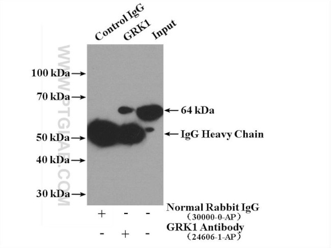 GRK1 Antibody in Immunoprecipitation (IP)