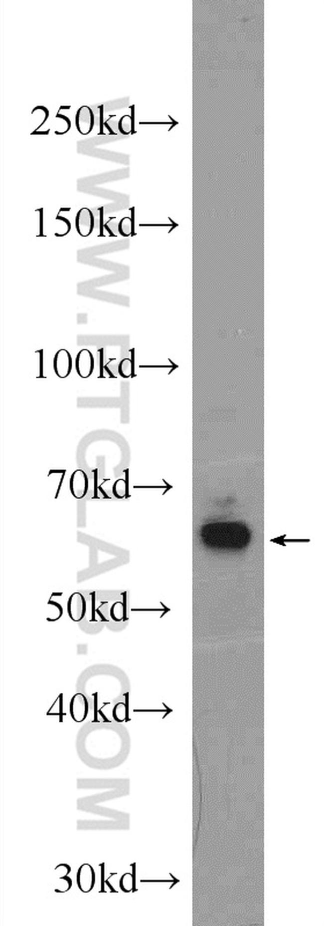 GRK1 Antibody in Western Blot (WB)