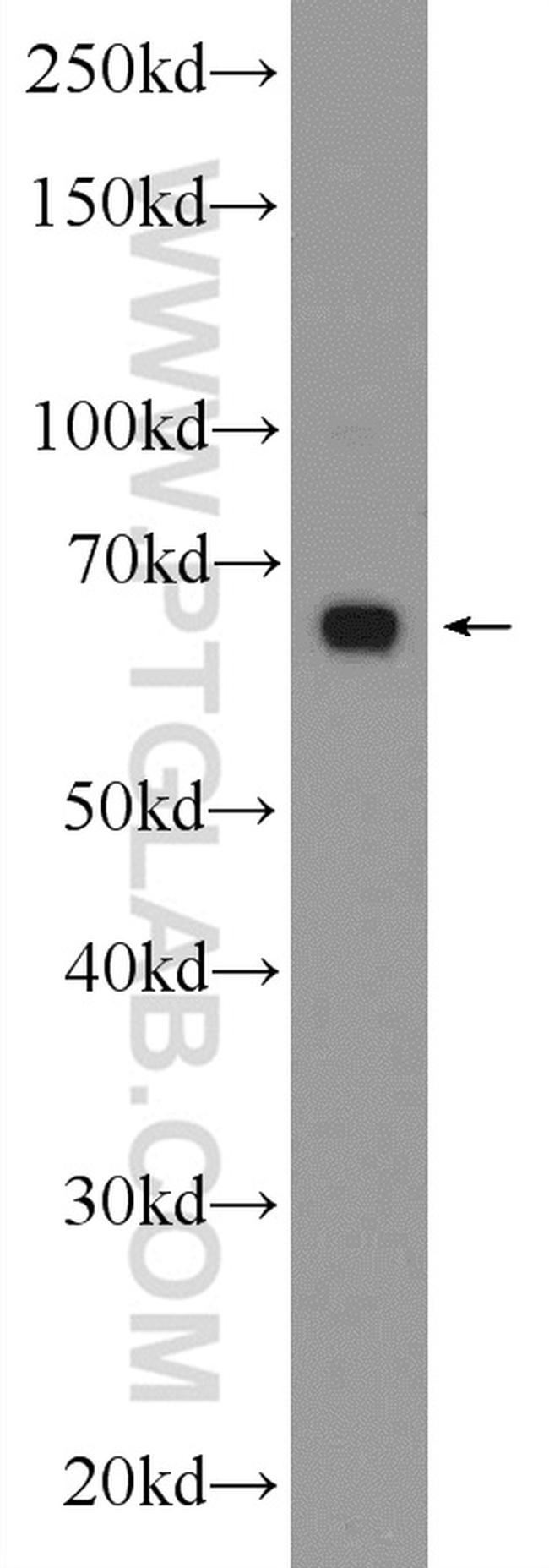 SLC22A1 Antibody in Western Blot (WB)