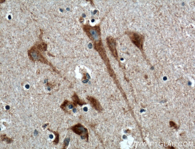 NPBWR1 Antibody in Immunohistochemistry (Paraffin) (IHC (P))