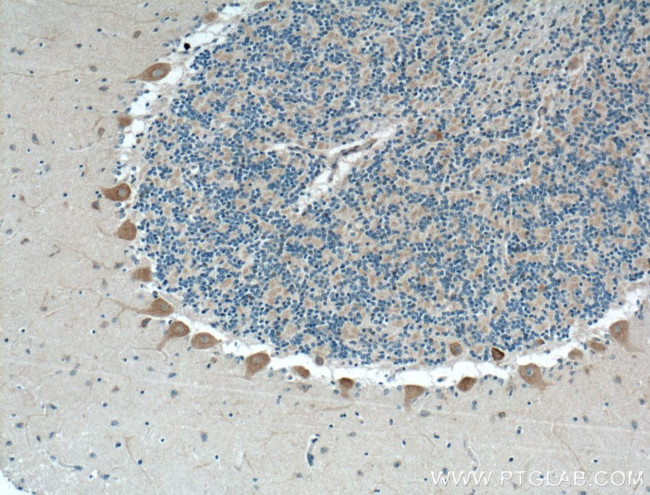 NPBWR1 Antibody in Immunohistochemistry (Paraffin) (IHC (P))