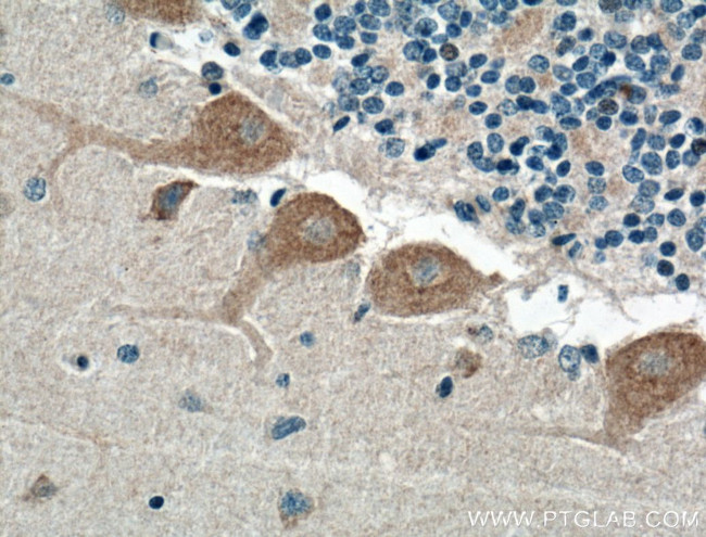 NPBWR1 Antibody in Immunohistochemistry (Paraffin) (IHC (P))