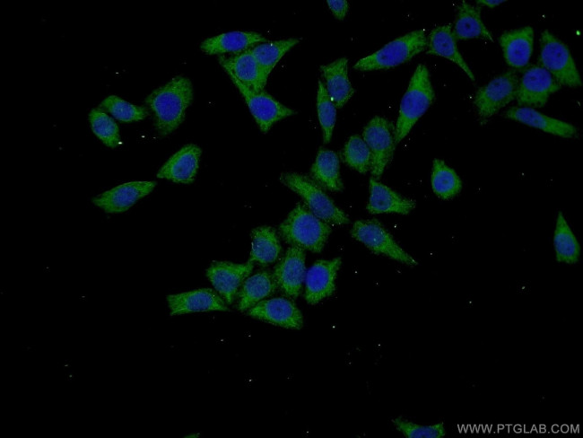 TARSL2 Antibody in Immunocytochemistry (ICC/IF)