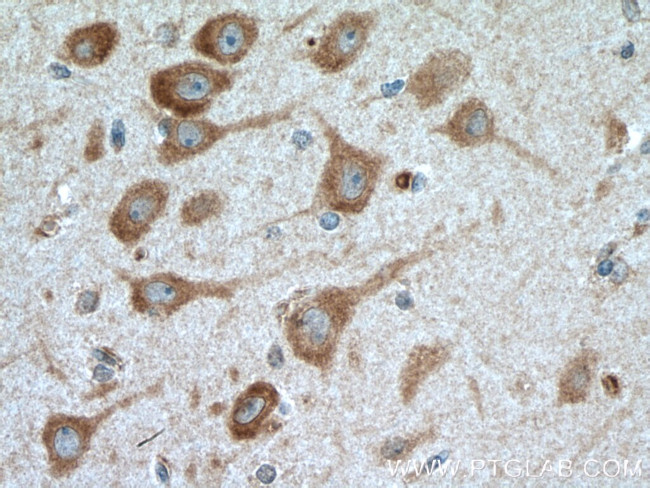 TARSL2 Antibody in Immunohistochemistry (Paraffin) (IHC (P))