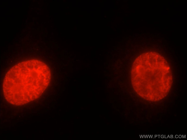 TOP2A Antibody in Immunocytochemistry (ICC/IF)