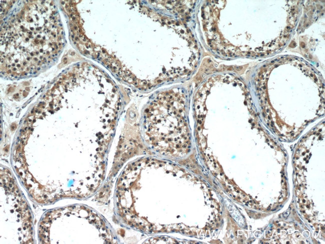 TOP2A Antibody in Immunohistochemistry (Paraffin) (IHC (P))