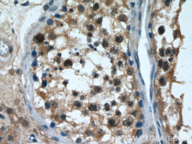 TOP2A Antibody in Immunohistochemistry (Paraffin) (IHC (P))