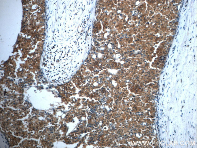 TOP2A Antibody in Immunohistochemistry (Paraffin) (IHC (P))