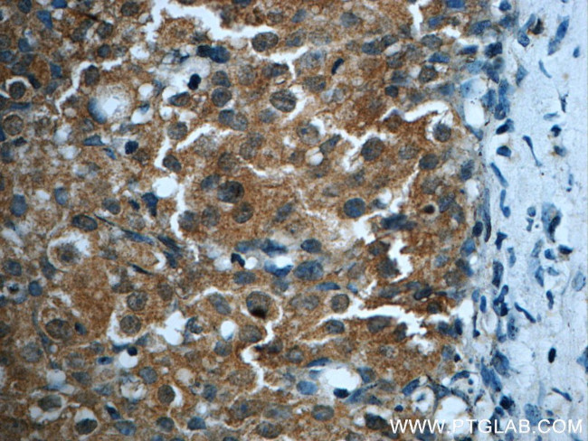 TOP2A Antibody in Immunohistochemistry (Paraffin) (IHC (P))