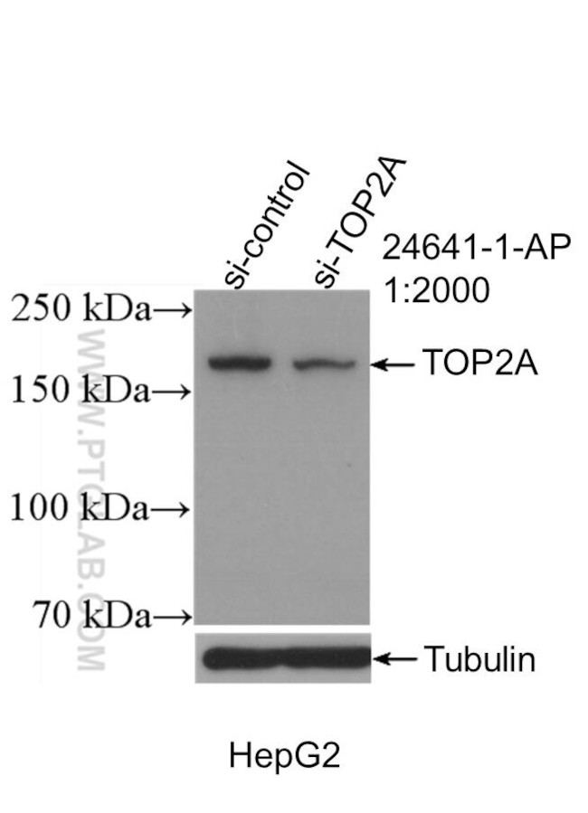 TOP2A Antibody in Western Blot (WB)