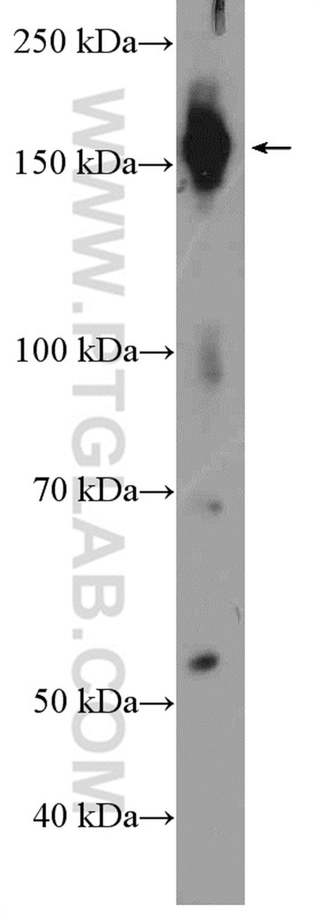 TOP2A Antibody in Western Blot (WB)