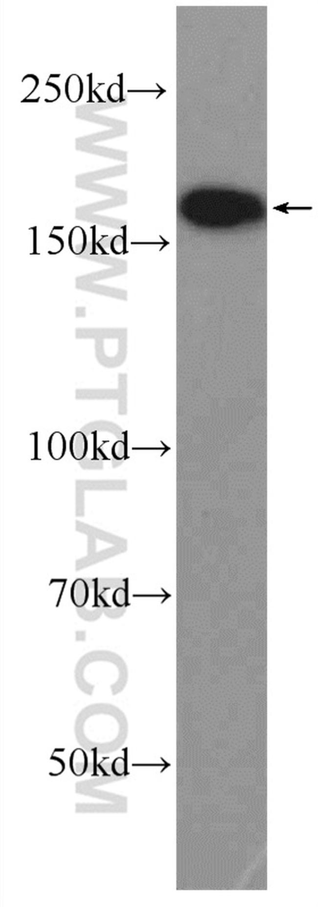 TOP2A Antibody in Western Blot (WB)