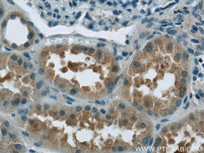 C12orf65 Antibody in Immunohistochemistry (Paraffin) (IHC (P))