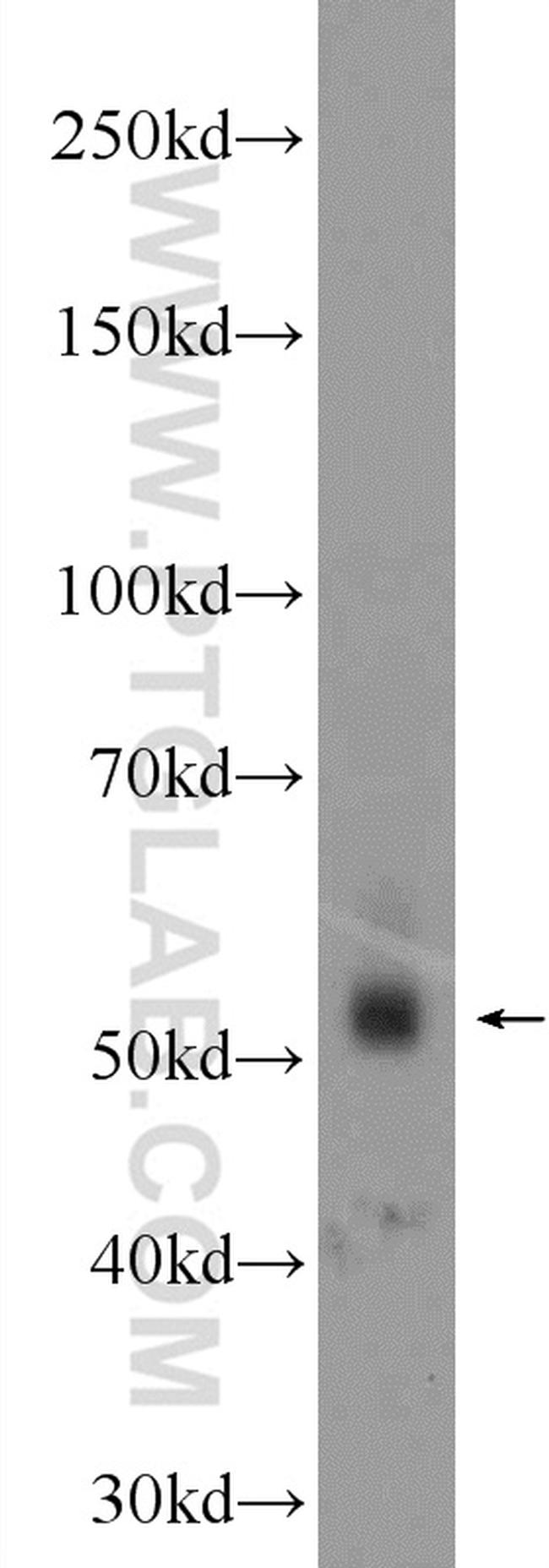 ZNF71 Antibody in Western Blot (WB)