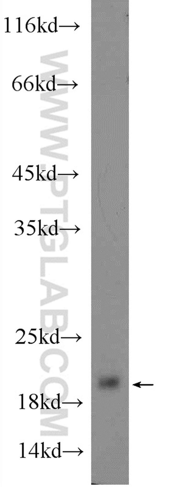 GKN2 Antibody in Western Blot (WB)