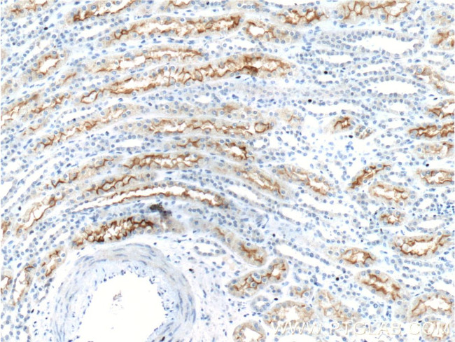 SGLT2 Antibody in Immunohistochemistry (Paraffin) (IHC (P))