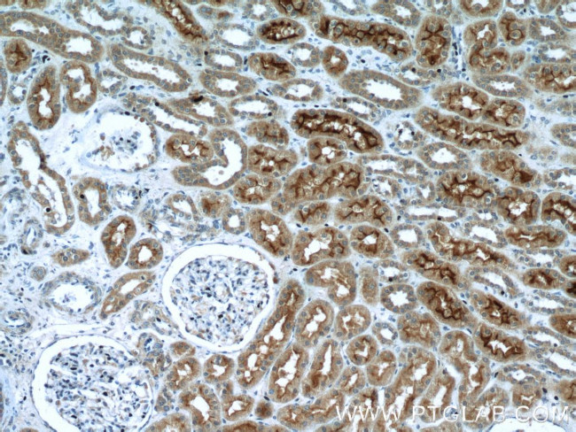 SGLT2 Antibody in Immunohistochemistry (Paraffin) (IHC (P))