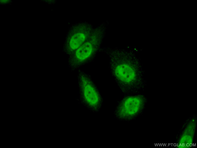 SRA1 Antibody in Immunocytochemistry (ICC/IF)