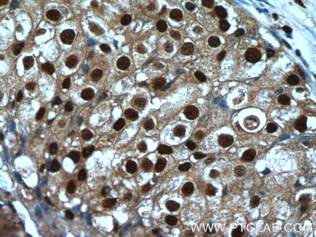 SRA1 Antibody in Immunohistochemistry (Paraffin) (IHC (P))