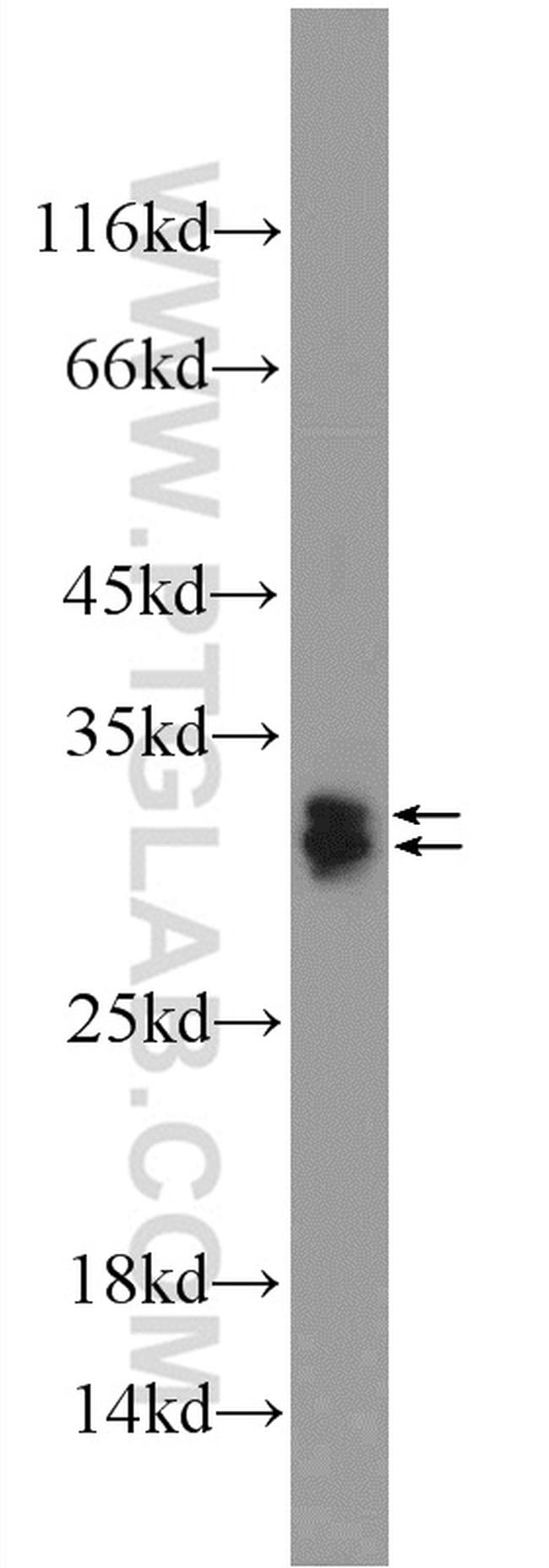 SRA1 Antibody in Western Blot (WB)