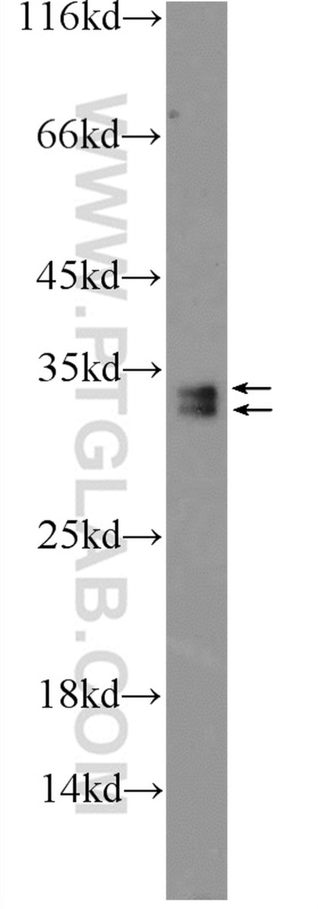 SRA1 Antibody in Western Blot (WB)