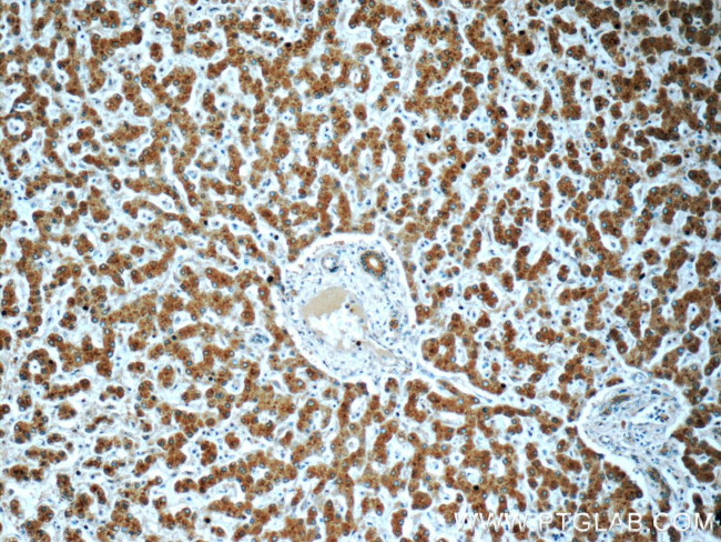 PHKA2 Antibody in Immunohistochemistry (Paraffin) (IHC (P))