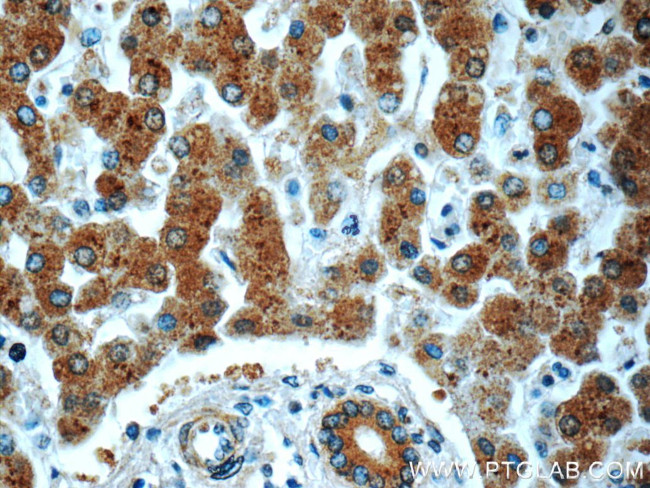 PHKA2 Antibody in Immunohistochemistry (Paraffin) (IHC (P))