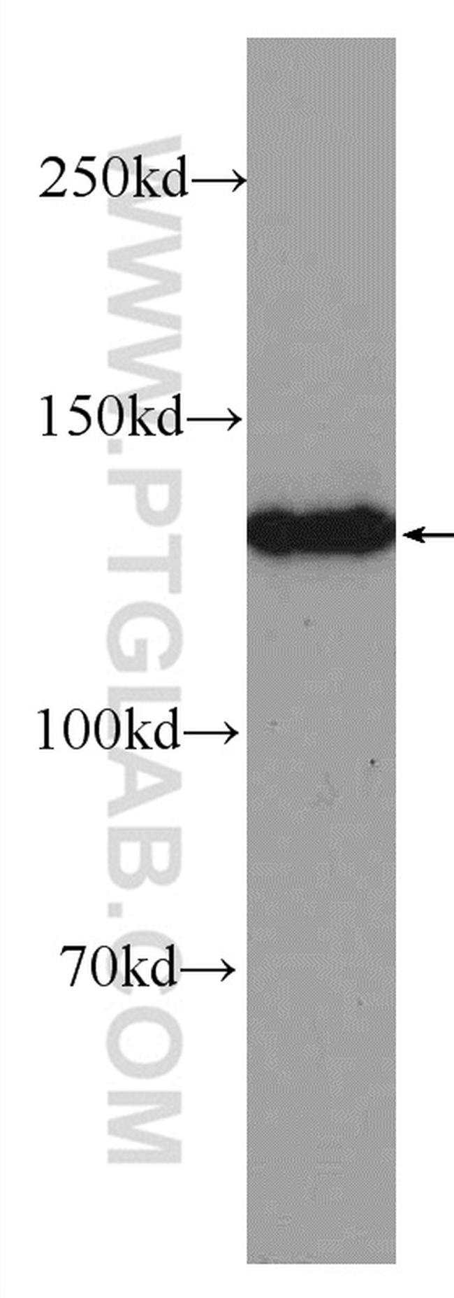 PHKA2 Antibody in Western Blot (WB)