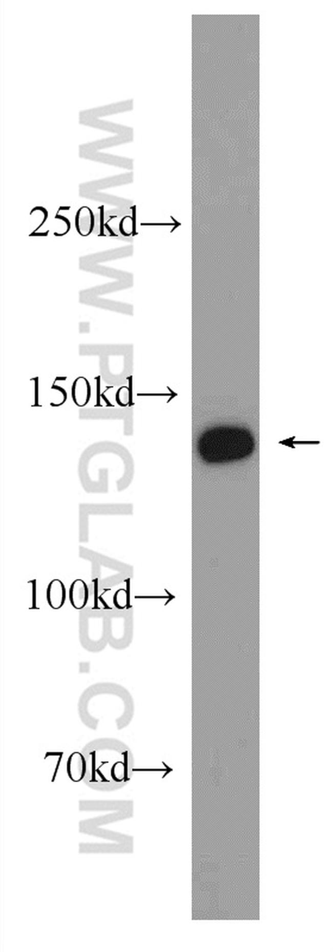 PHKA2 Antibody in Western Blot (WB)