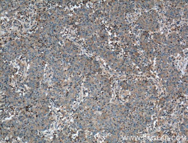 VN1R3 Antibody in Immunohistochemistry (Paraffin) (IHC (P))