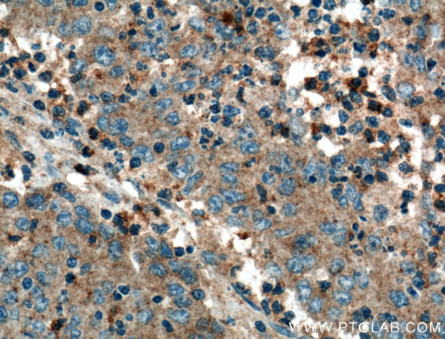 VN1R3 Antibody in Immunohistochemistry (Paraffin) (IHC (P))