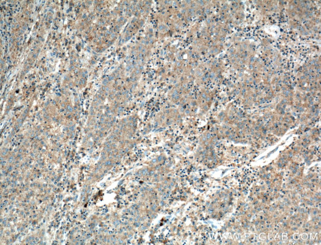 VN1R3 Antibody in Immunohistochemistry (Paraffin) (IHC (P))