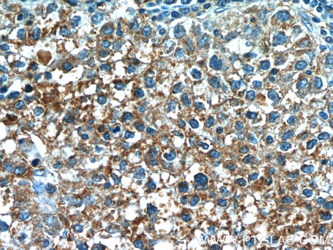 VN1R3 Antibody in Immunohistochemistry (Paraffin) (IHC (P))