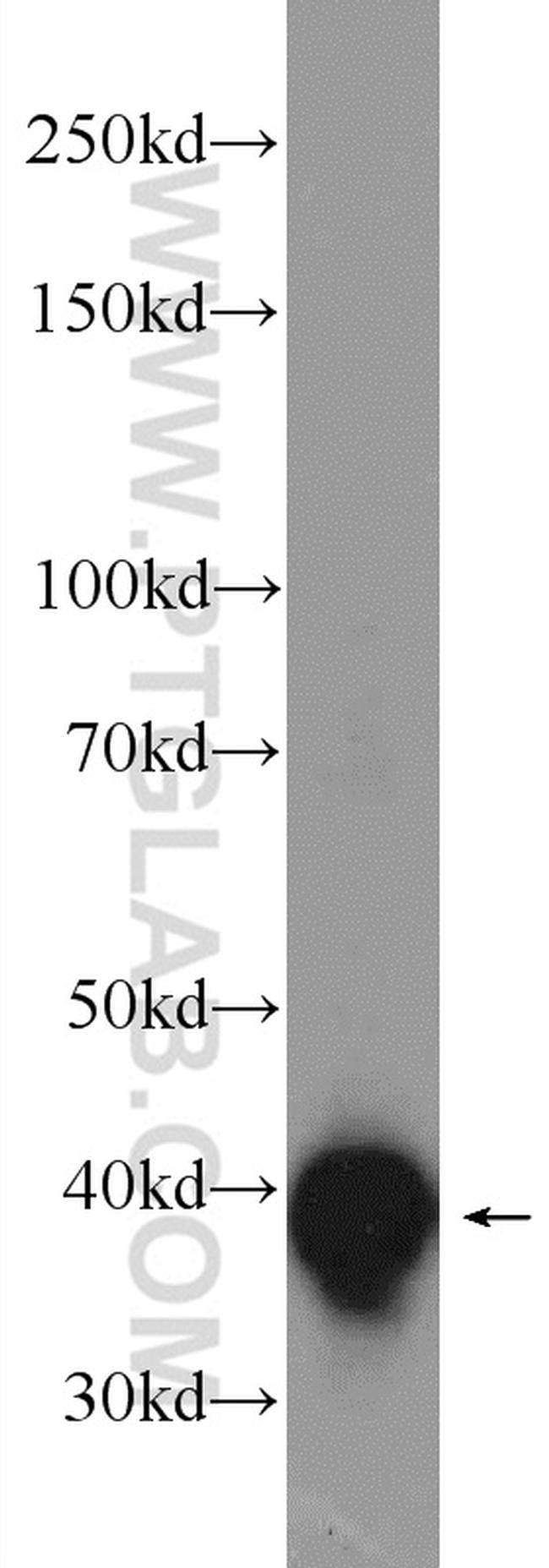 LRPAP1 Antibody in Western Blot (WB)