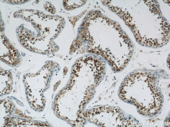 LRPAP1 Antibody in Immunohistochemistry (Paraffin) (IHC (P))