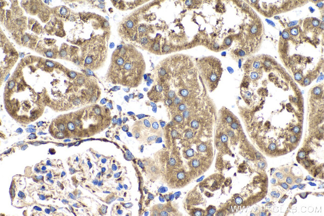 LRPAP1 Antibody in Immunohistochemistry (Paraffin) (IHC (P))