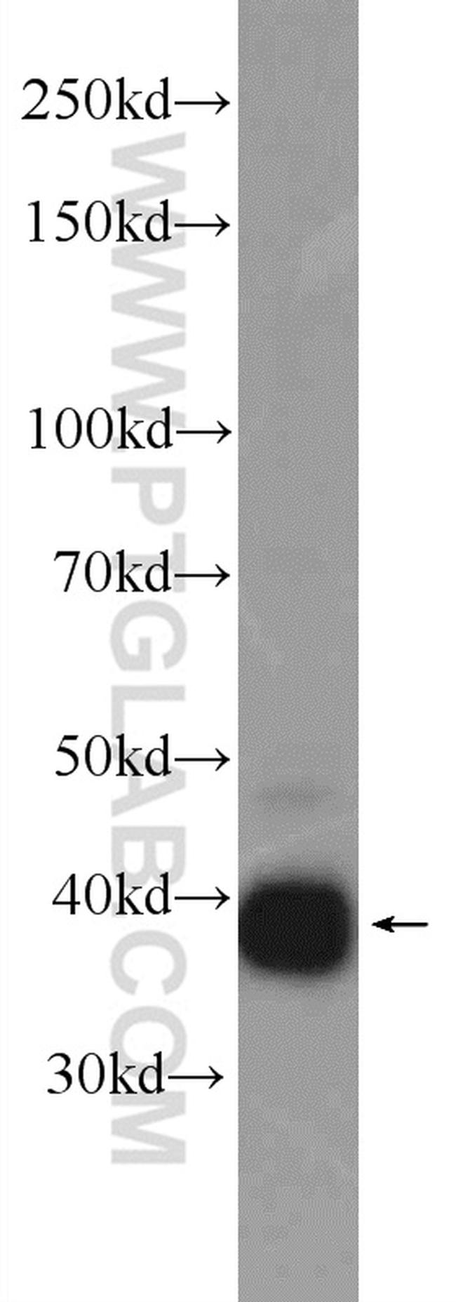 LRPAP1 Antibody in Western Blot (WB)