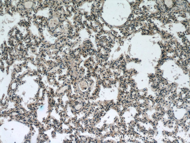 GGT7 Antibody in Immunohistochemistry (Paraffin) (IHC (P))