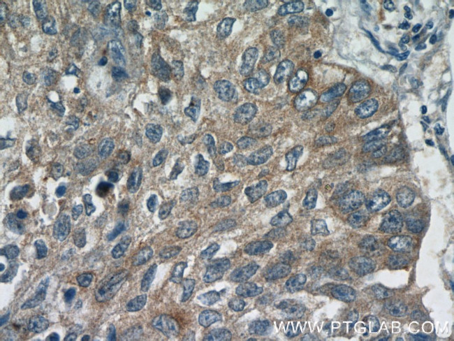 GGT7 Antibody in Immunohistochemistry (Paraffin) (IHC (P))