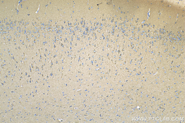 SYNJ1 Antibody in Immunohistochemistry (Paraffin) (IHC (P))