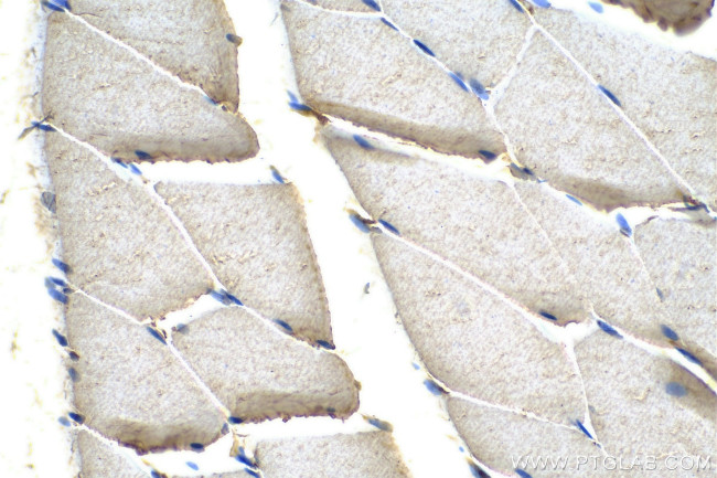 SYNJ1 Antibody in Immunohistochemistry (Paraffin) (IHC (P))