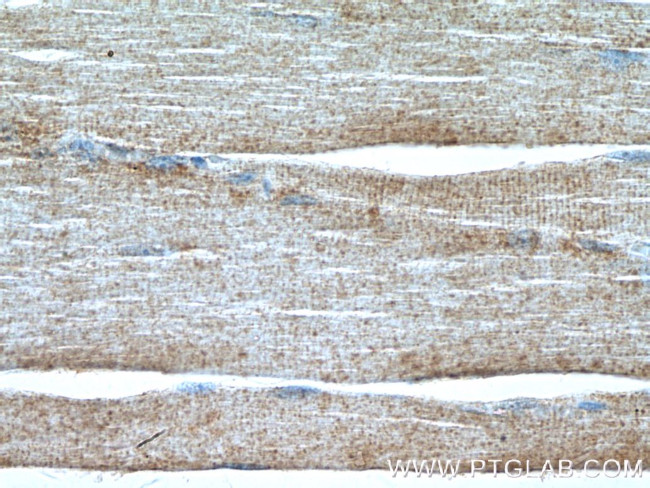 SYNJ1 Antibody in Immunohistochemistry (Paraffin) (IHC (P))