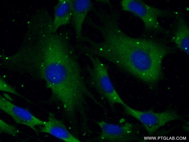 SYNJ1 Antibody in Immunocytochemistry (ICC/IF)