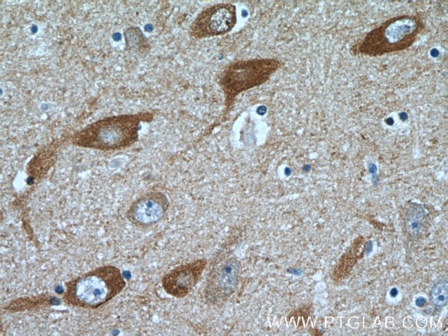 SYNJ1 Antibody in Immunohistochemistry (Paraffin) (IHC (P))