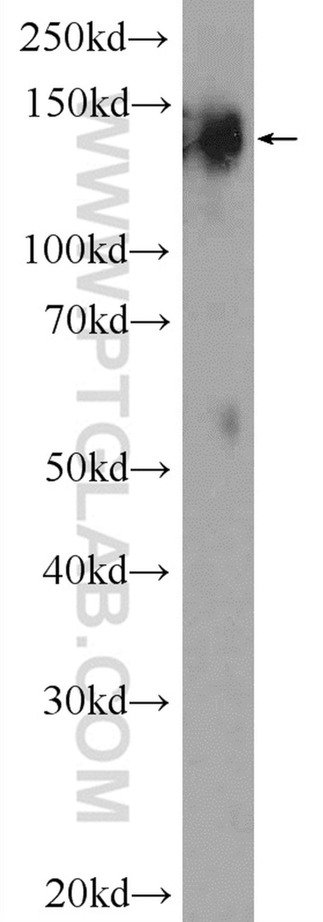 SYNJ1 Antibody in Western Blot (WB)