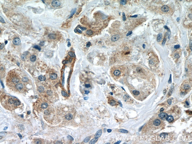 CCDC99 Antibody in Immunohistochemistry (Paraffin) (IHC (P))