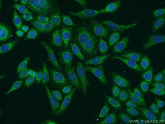 EYA4 Antibody in Immunocytochemistry (ICC/IF)