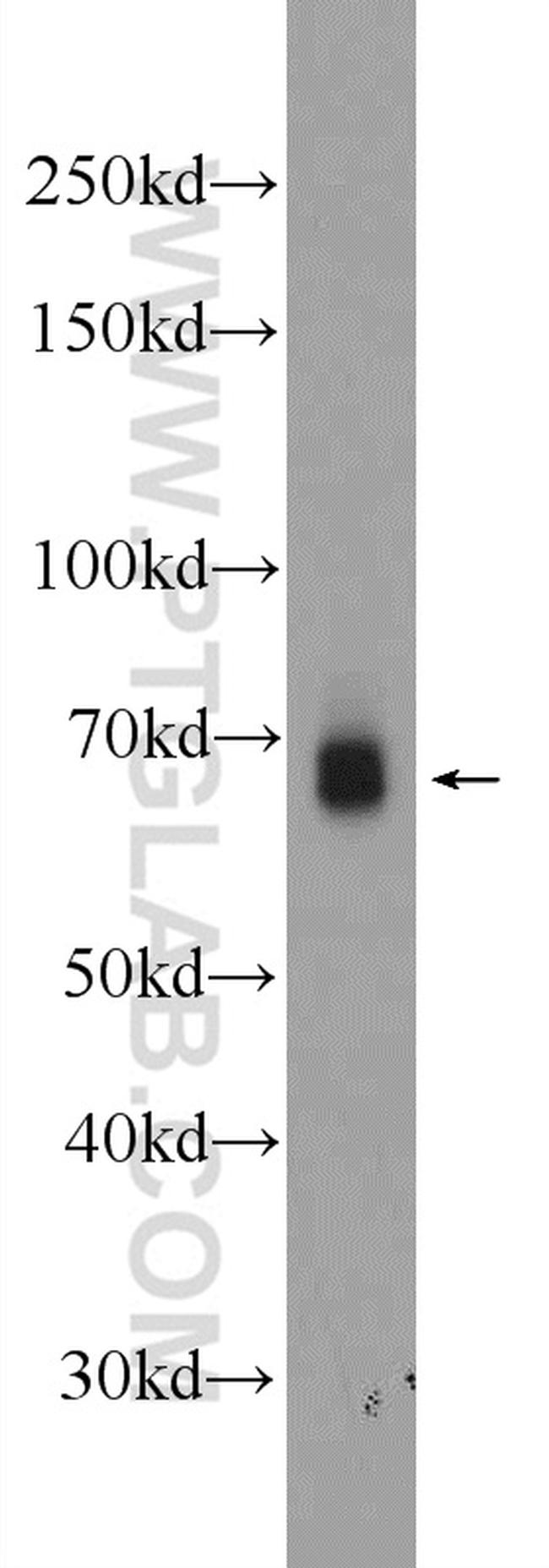 EYA4 Antibody in Western Blot (WB)