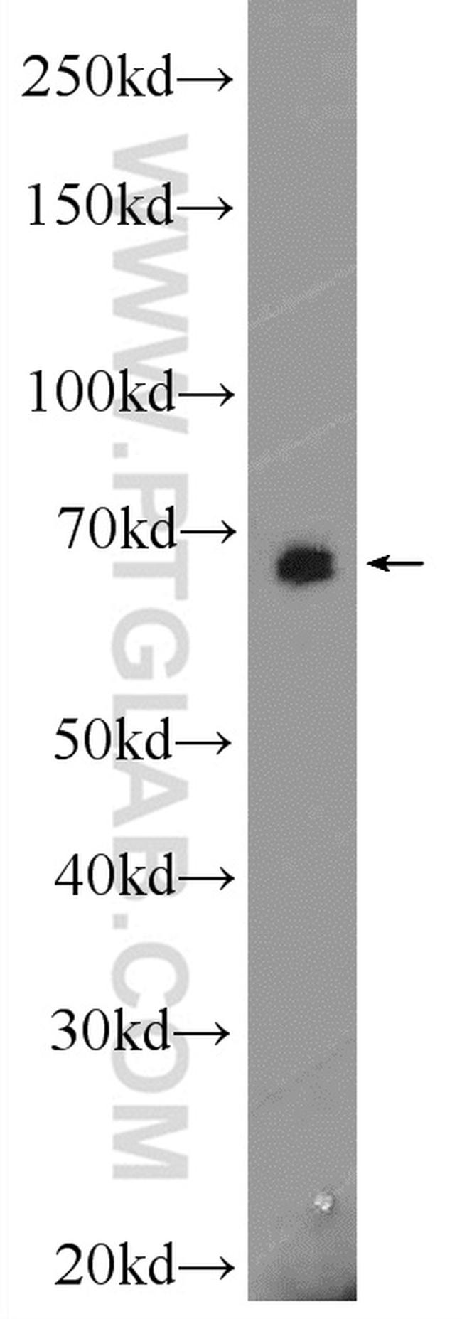 EYA4 Antibody in Western Blot (WB)