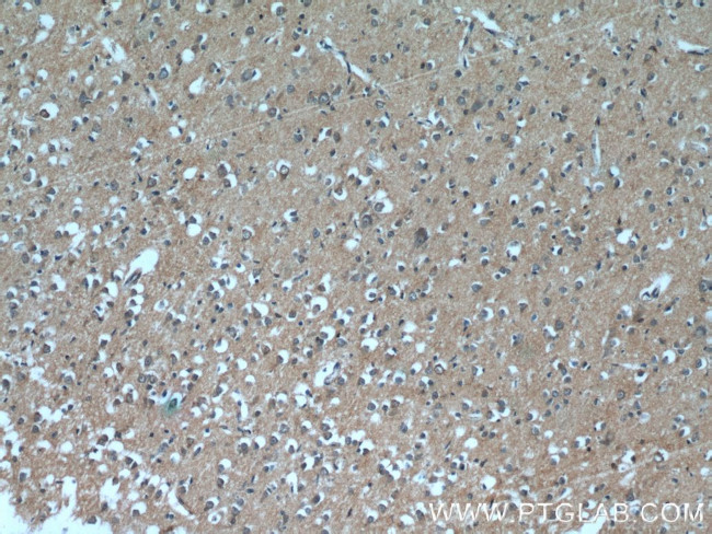 DAOA Antibody in Immunohistochemistry (Paraffin) (IHC (P))